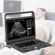 Ultrassom vascular cardíaco Máquina Requipo De Ultrasonido de Doppler da cor do m do diagnóstico b 2B/4B/de Sonoscape E2 Ecografo