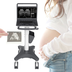 Ultrassom vascular cardíaco Máquina Requipo De Ultrasonido de Doppler da cor do m do diagnóstico b 2B/4B/de Sonoscape E2 Ecografo